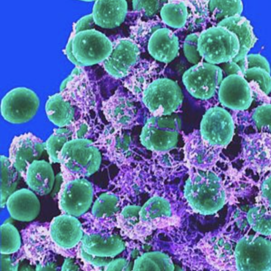 small spherical bacteria clinging to a purple spongy medium